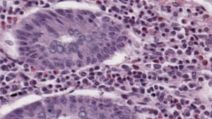 Blur Filter — After