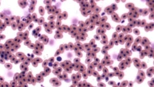 Brightness Filter — After