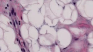 Gaussian Blur Filter — After