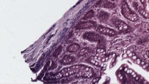 Level Clipping Filter — Before