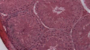 Sharpen Filter — Before