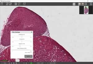 Level Clipping Filter