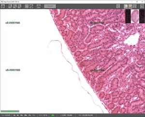 Whole Scan Image with Watermarked Fields